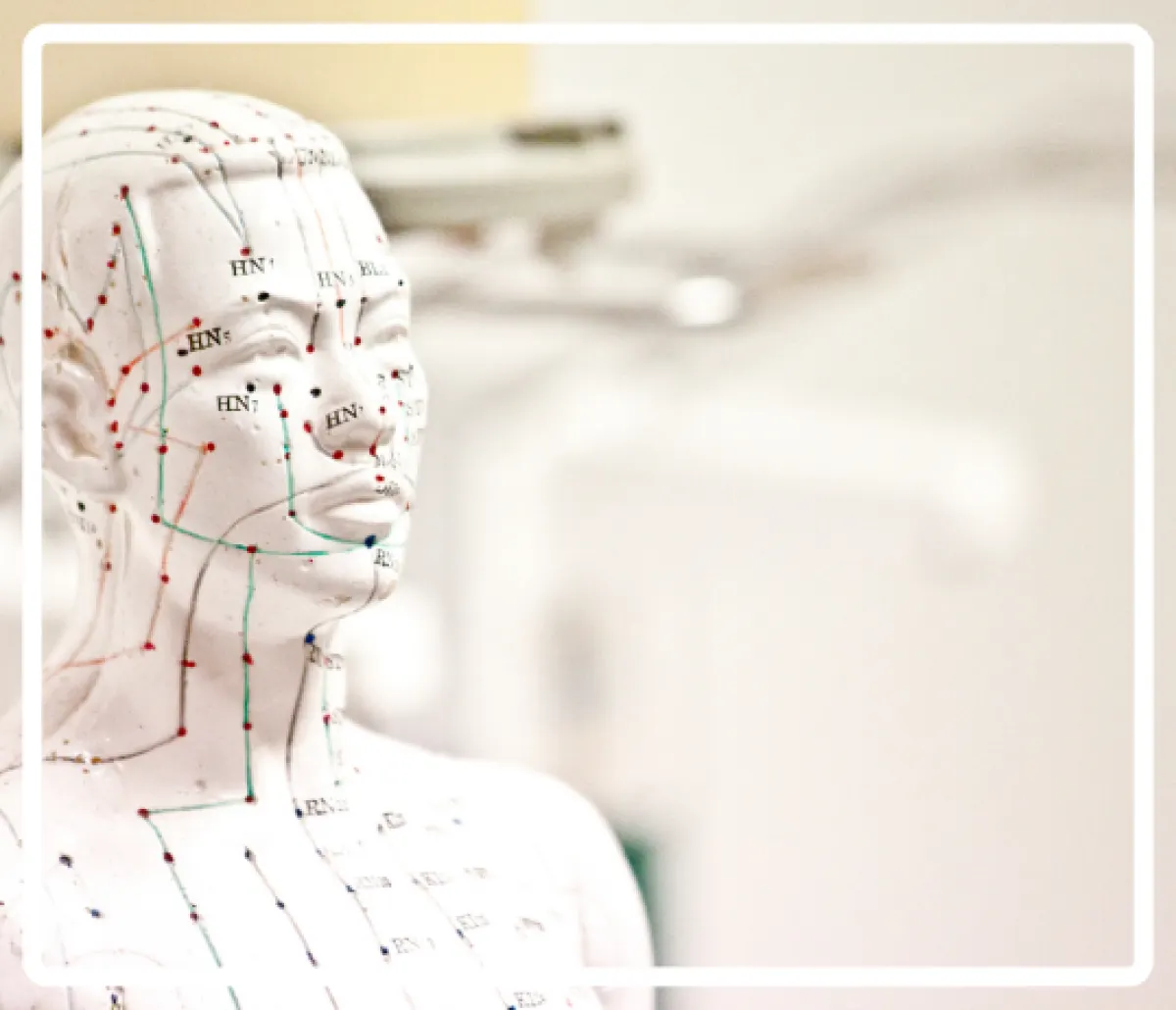 What is dry needling? How it differs from acupuncture