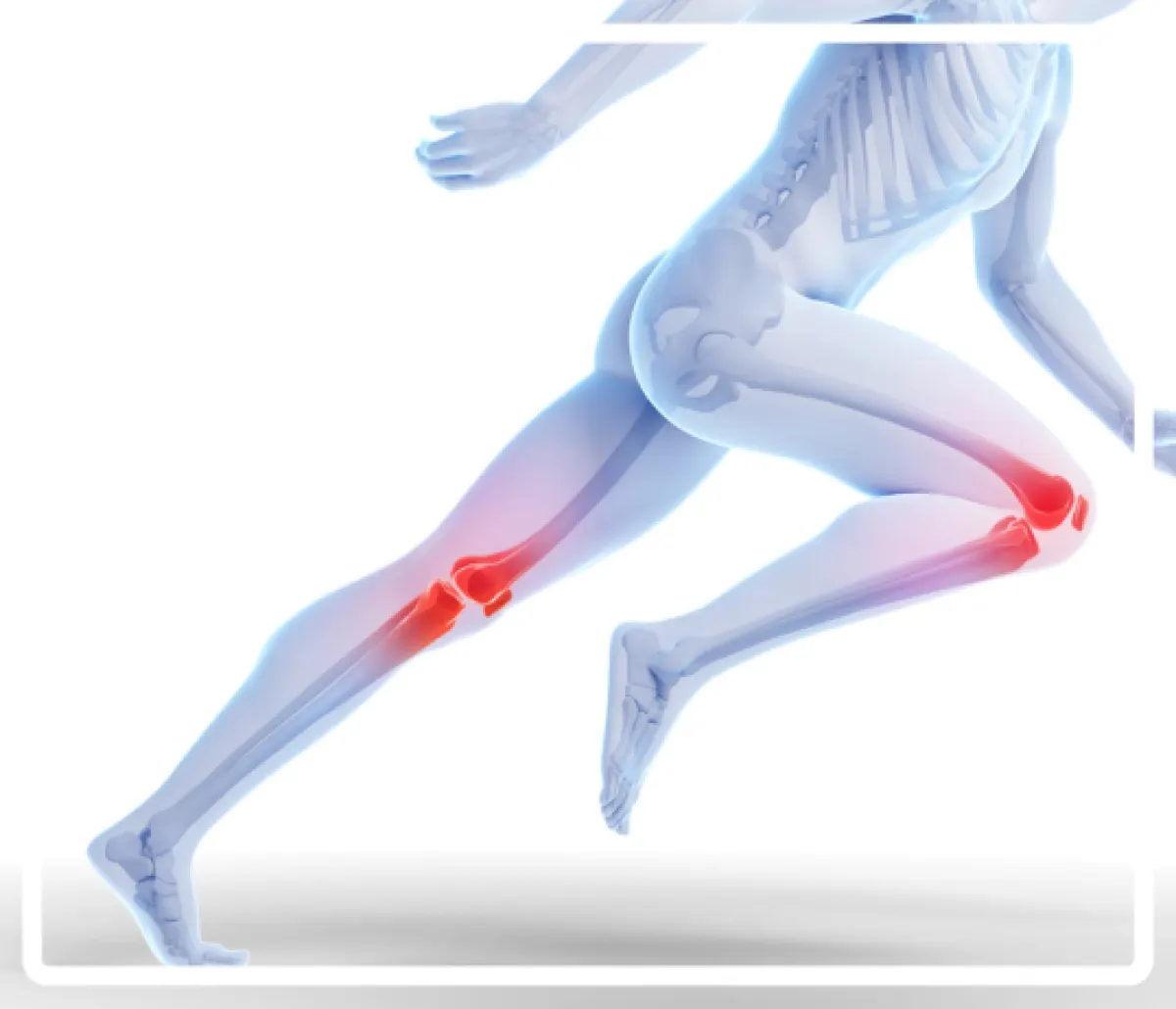 Runner's knee (patellofemoral pain syndrome): causes and rehab
