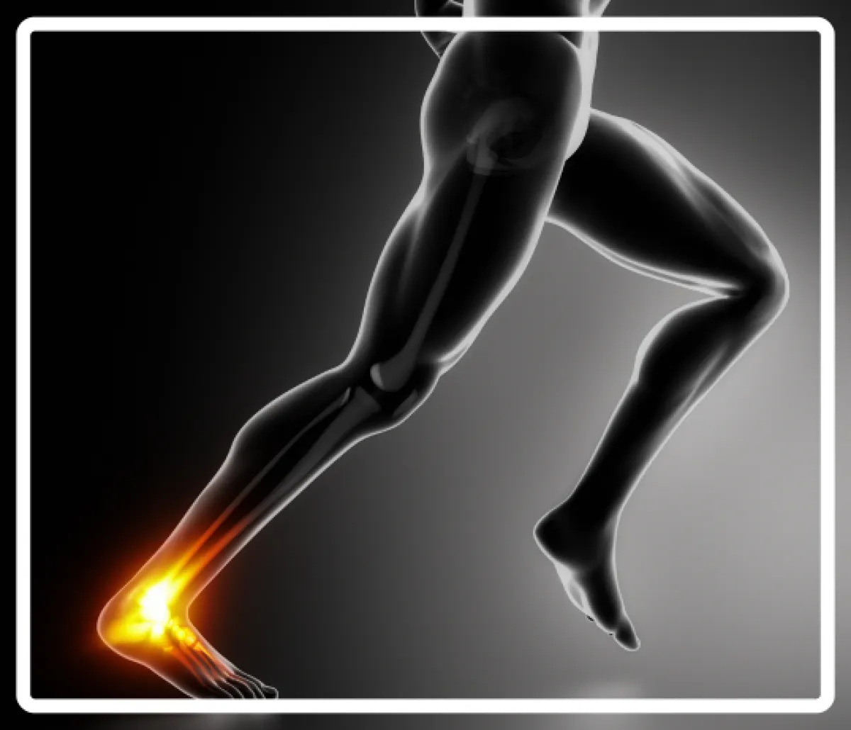 Achilles tendinitis: symptoms, causes and treatment